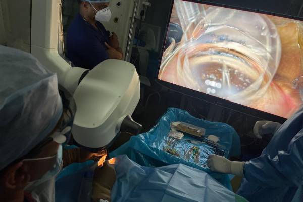 advanced-3-d-microscope-glaucoma-surgery