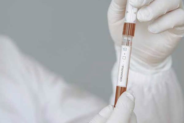 coronavirus-test