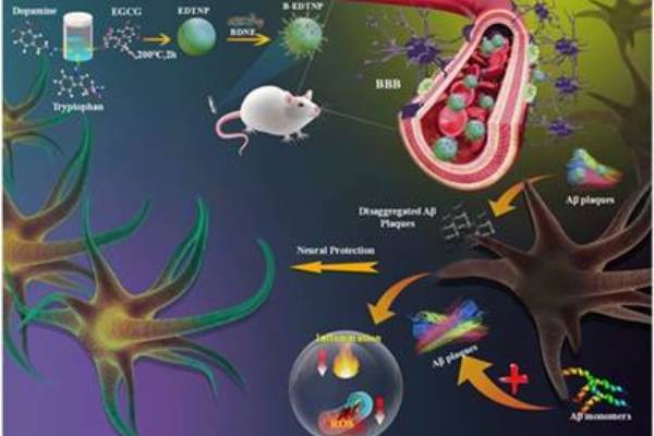 alzheimer-treatment-new-technique